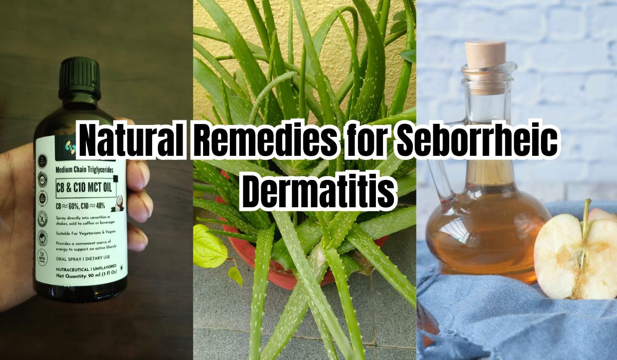 Natural Remedies for Seborrheic Dermatitis